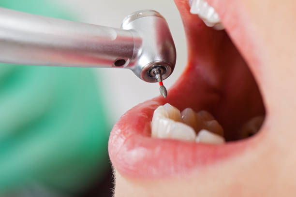 Best Emergency Treatment for Jaw Pain or Injury in South Bend, IN